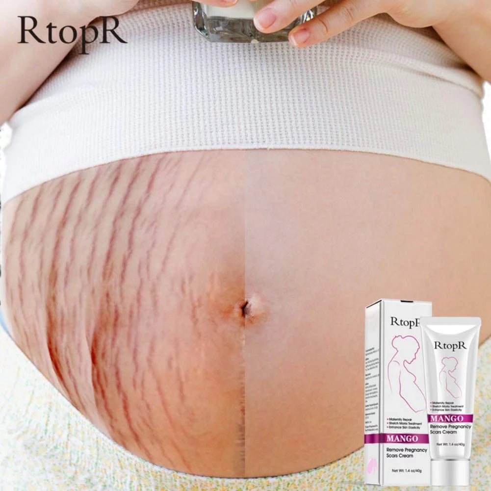 Rtopr Stretch Mark Cream for Pregnancy Repair Scar Slack Line Abdomen Stretch Marks Cream, Remove Stretch Marks from Pregnancy, Repair Scar Slack Line Abdomen Stretch Marks Postpartum