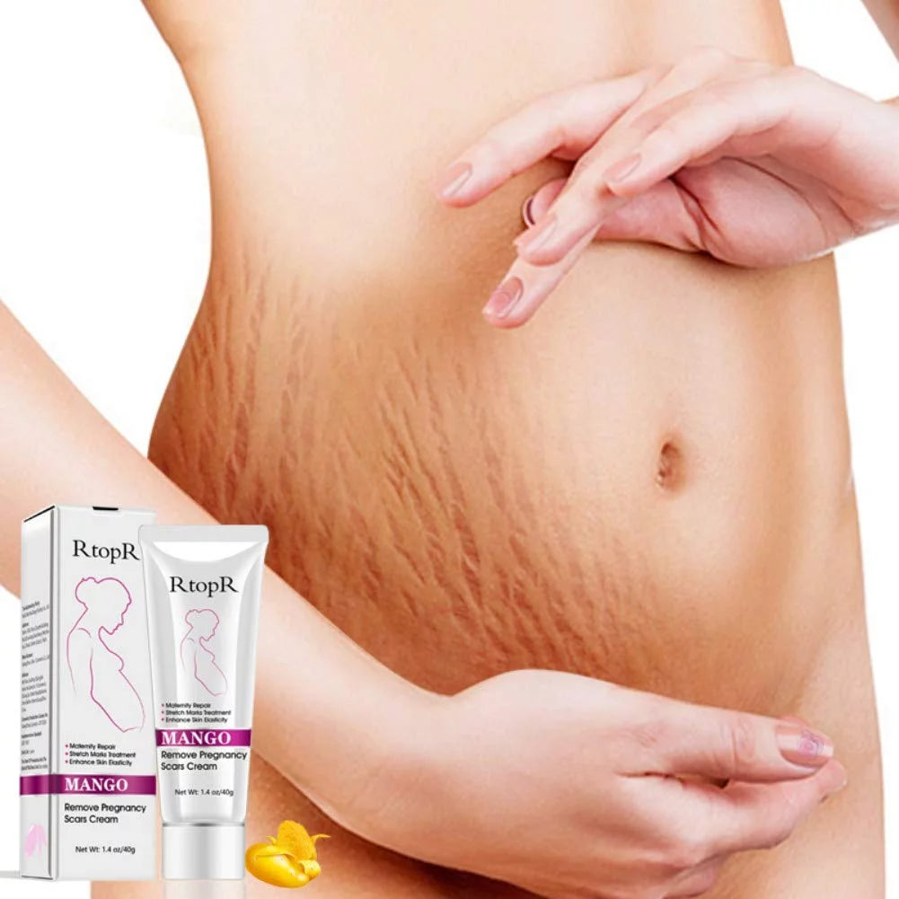 Rtopr Stretch Mark Cream for Pregnancy Repair Scar Slack Line Abdomen Stretch Marks Cream, Remove Stretch Marks from Pregnancy, Repair Scar Slack Line Abdomen Stretch Marks Postpartum