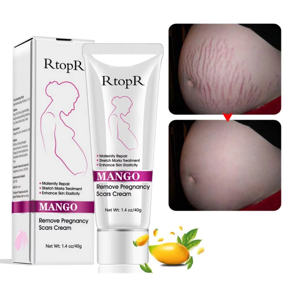 Rtopr Stretch Mark Cream for Pregnancy Repair Scar Slack Line Abdomen Stretch Marks Cream, Remove Stretch Marks from Pregnancy, Repair Scar Slack Line Abdomen Stretch Marks Postpartum